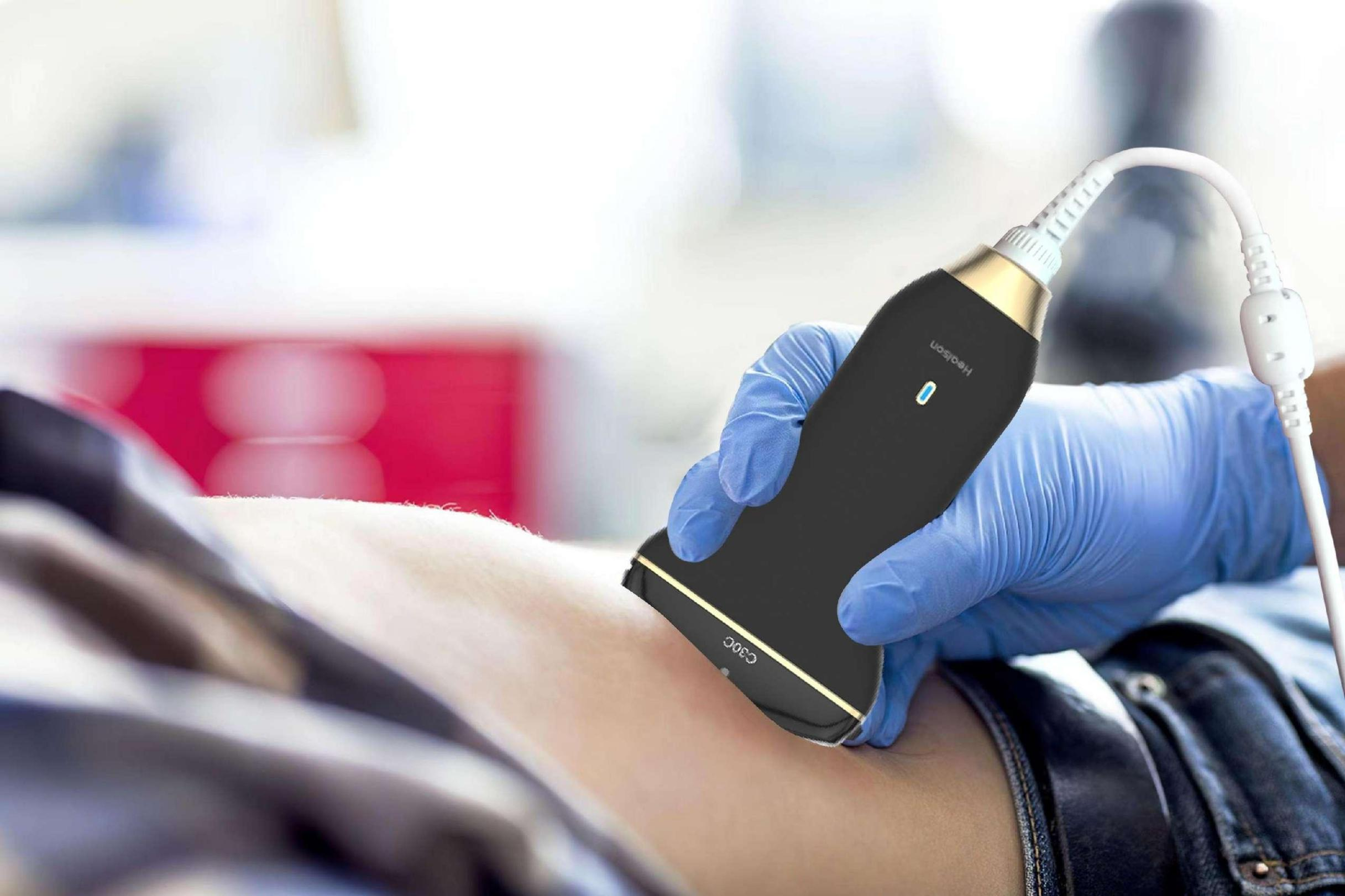 微型彩色超声诊断系统（images 1）